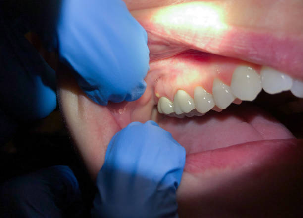 Best Emergency Cosmetic Dentistry (e.g., broken veneers) in Huntington Station, NY
