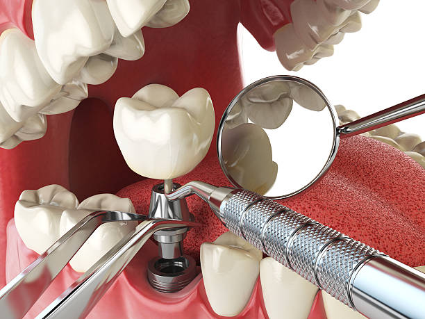 Best Emergency Denture Repair in Huntington Station, NY
